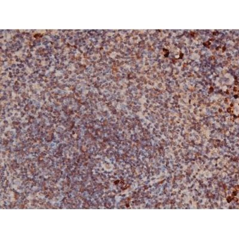 Validation Data - Anti-p70 S6 Kinase (phospho Thr252) Antibody (A255483)