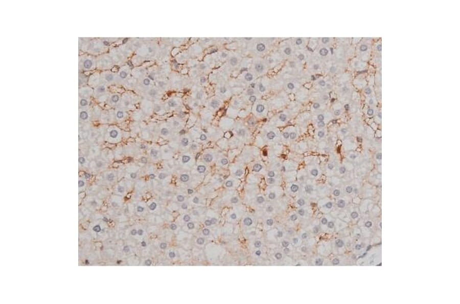 Validation Data - Anti-p70 S6 Kinase (phospho Thr252) Antibody (A255483)