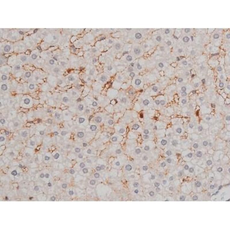 Validation Data - Anti-p70 S6 Kinase (phospho Thr252) Antibody (A255483)