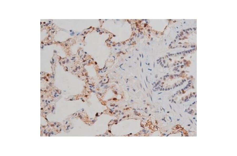 Validation Data - Anti-p70 S6 Kinase (phospho Thr252) Antibody (A255483)
