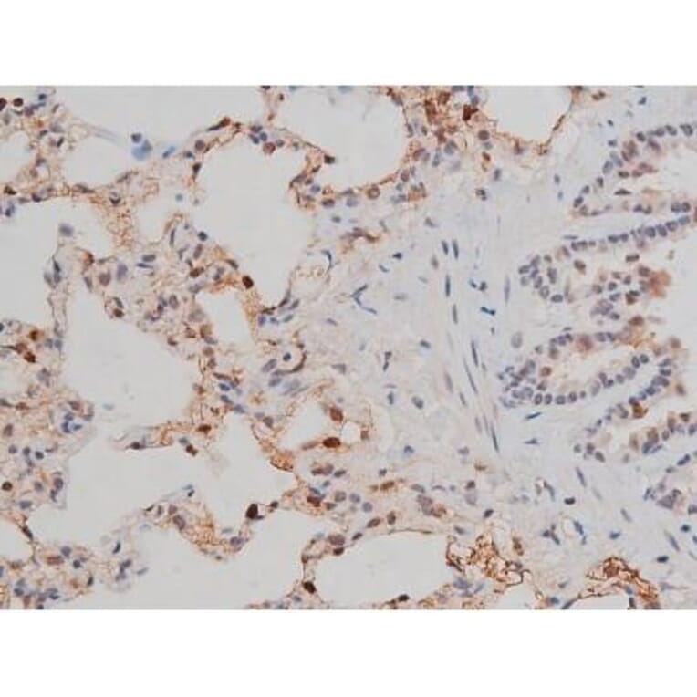 Validation Data - Anti-p70 S6 Kinase (phospho Thr252) Antibody (A255483)