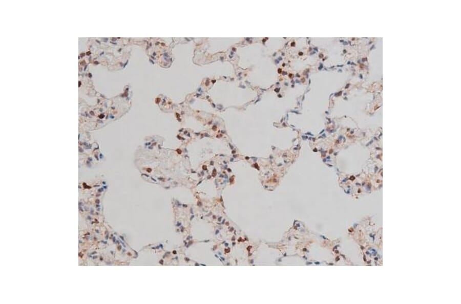 Validation Data - Anti-p70 S6 Kinase (phospho Thr252) Antibody (A255483)