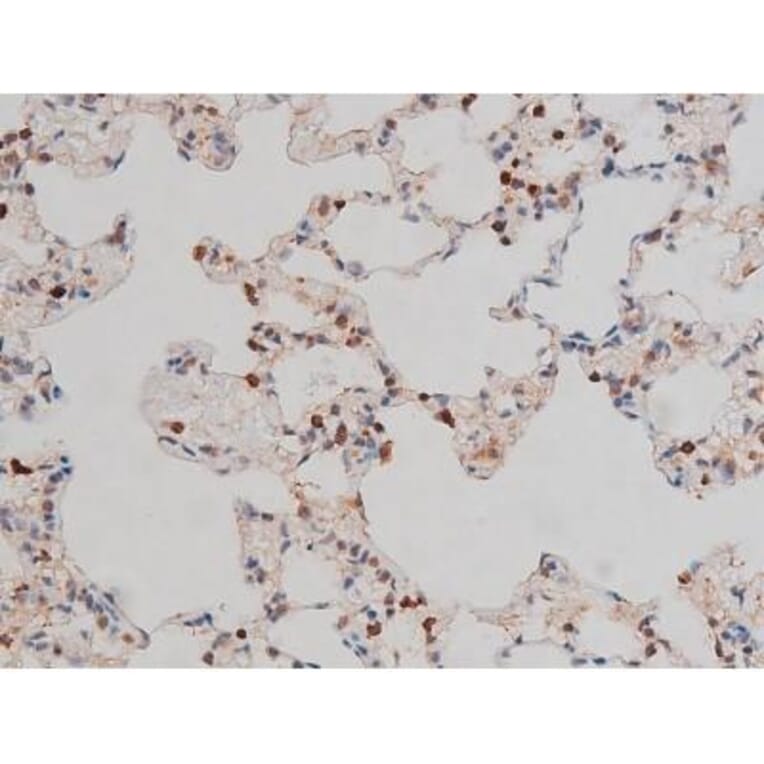 Validation Data - Anti-p70 S6 Kinase (phospho Thr252) Antibody (A255483)