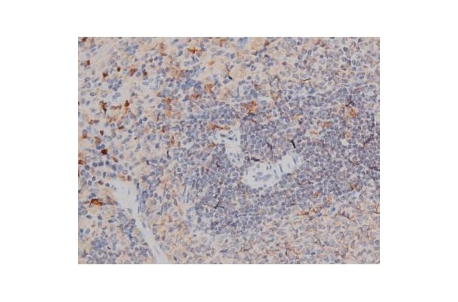 Validation Data - Anti-p70 S6 Kinase (phospho Thr252) Antibody (A255483)