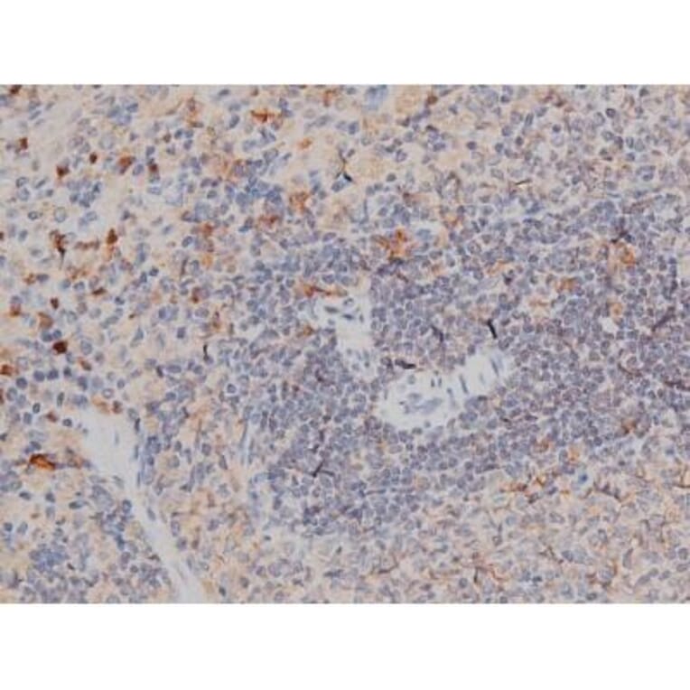 Validation Data - Anti-p70 S6 Kinase (phospho Thr252) Antibody (A255483)