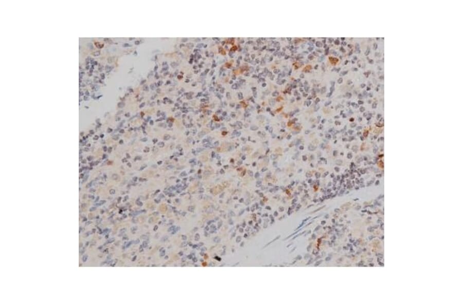 Validation Data - Anti-p70 S6 Kinase (phospho Thr252) Antibody (A255483)