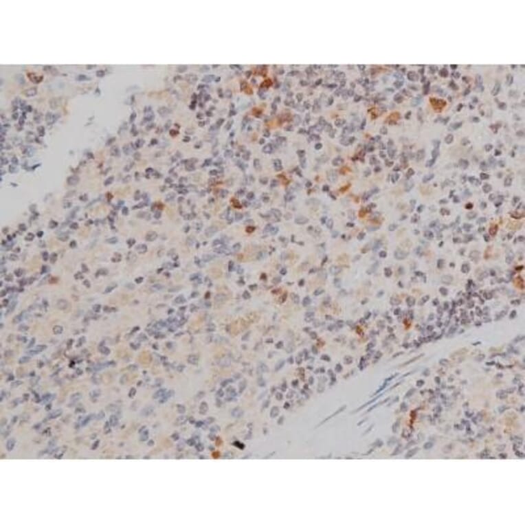 Validation Data - Anti-p70 S6 Kinase (phospho Thr252) Antibody (A255483)