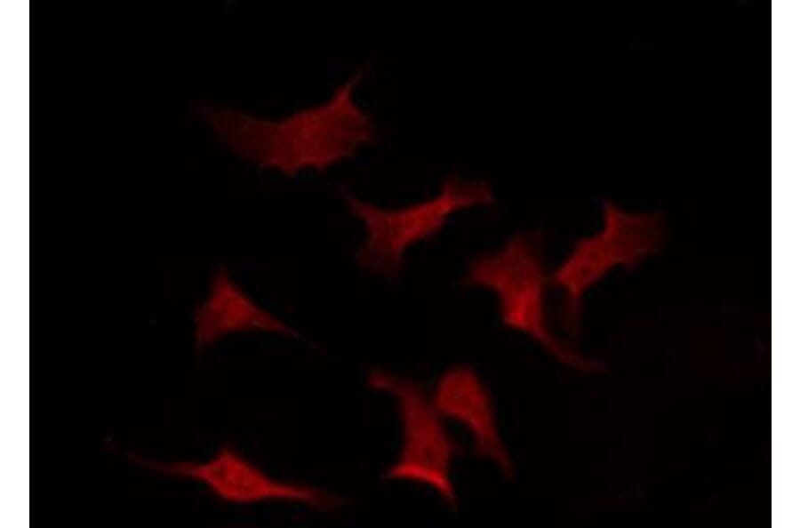 Validation Data - Anti-p70 S6 Kinase (phospho Thr252) Antibody (A255483)