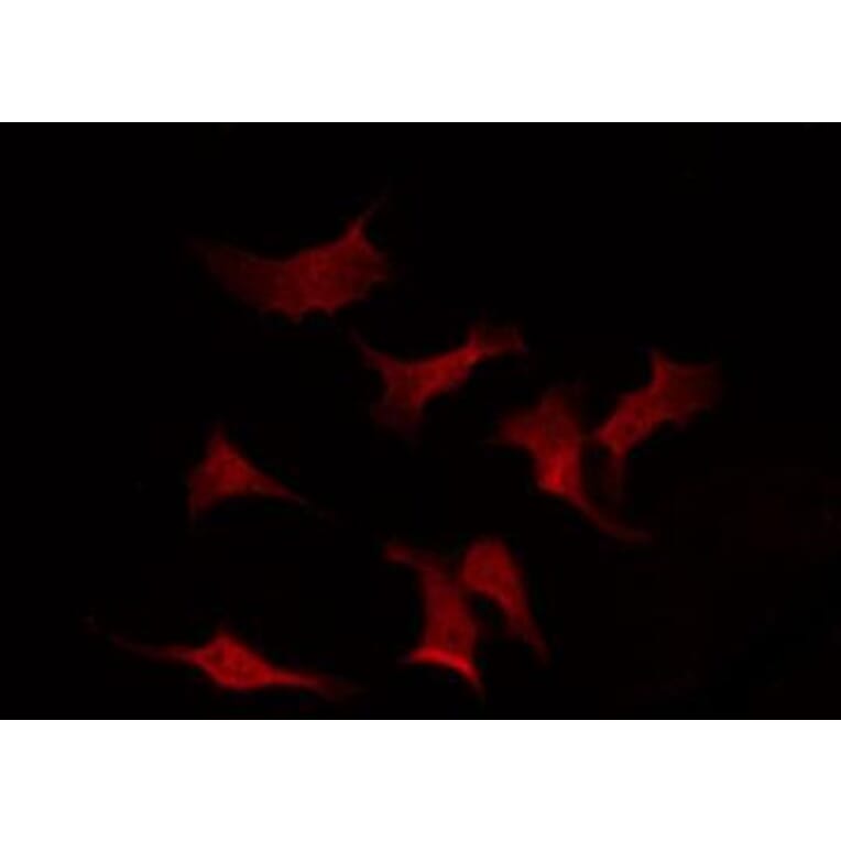 Validation Data - Anti-p70 S6 Kinase (phospho Thr252) Antibody (A255483)