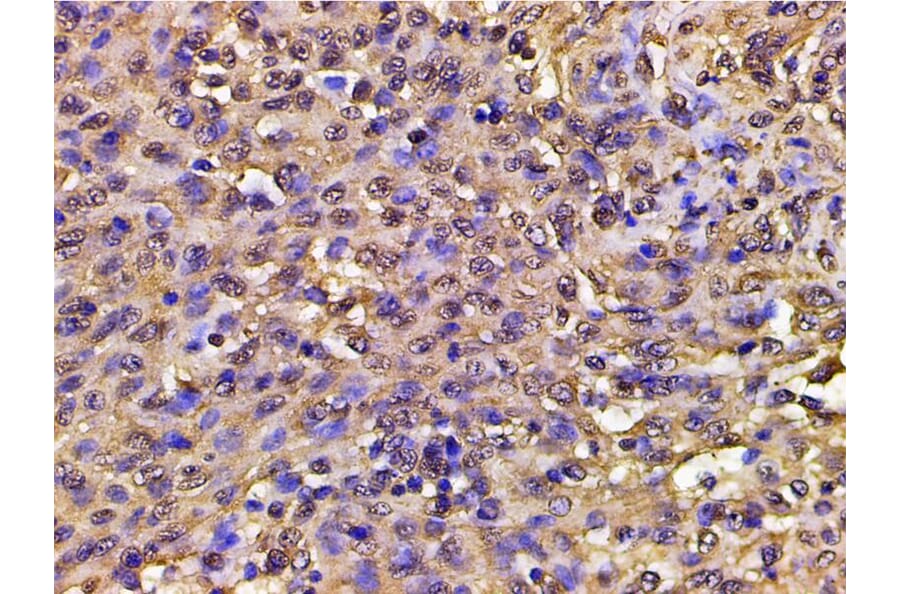 Validation Data - Anti-PI3K p85 alpha (phospho Tyr607) Antibody (A255498)