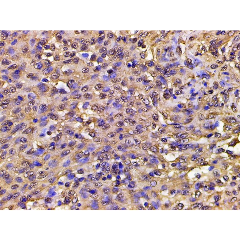 Validation Data - Anti-PI3K p85 alpha (phospho Tyr607) Antibody (A255498)