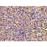 Validation Data - Anti-PI3K p85 alpha (phospho Tyr607) Antibody (A255498)