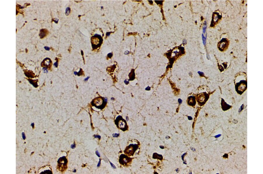Validation Data - Anti-PI3K p85 alpha (phospho Tyr607) Antibody (A255498)