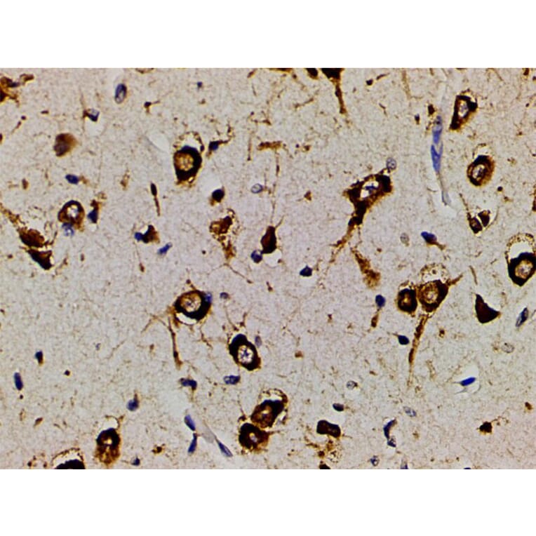 Validation Data - Anti-PI3K p85 alpha (phospho Tyr607) Antibody (A255498)