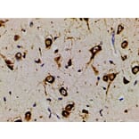 Validation Data - Anti-PI3K p85 alpha (phospho Tyr607) Antibody (A255498)