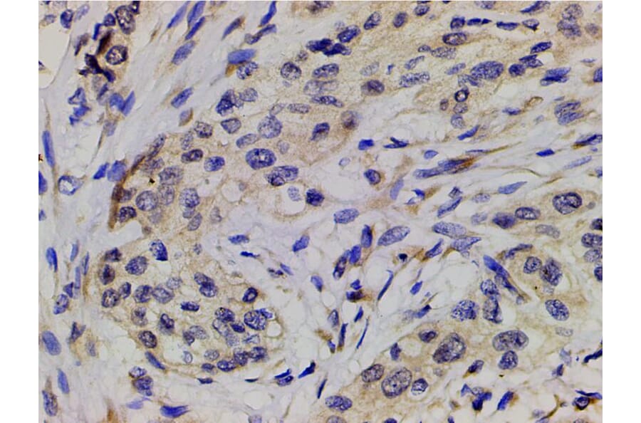 Validation Data - Anti-PI3K p85 alpha (phospho Tyr607) Antibody (A255498)