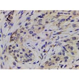 Validation Data - Anti-PI3K p85 alpha (phospho Tyr607) Antibody (A255498)