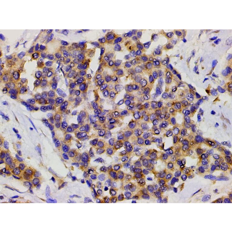 Validation Data - Anti-PI3K p85 alpha (phospho Tyr607) Antibody (A255498)