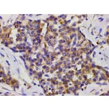 Validation Data - Anti-PI3K p85 alpha (phospho Tyr607) Antibody (A255498)