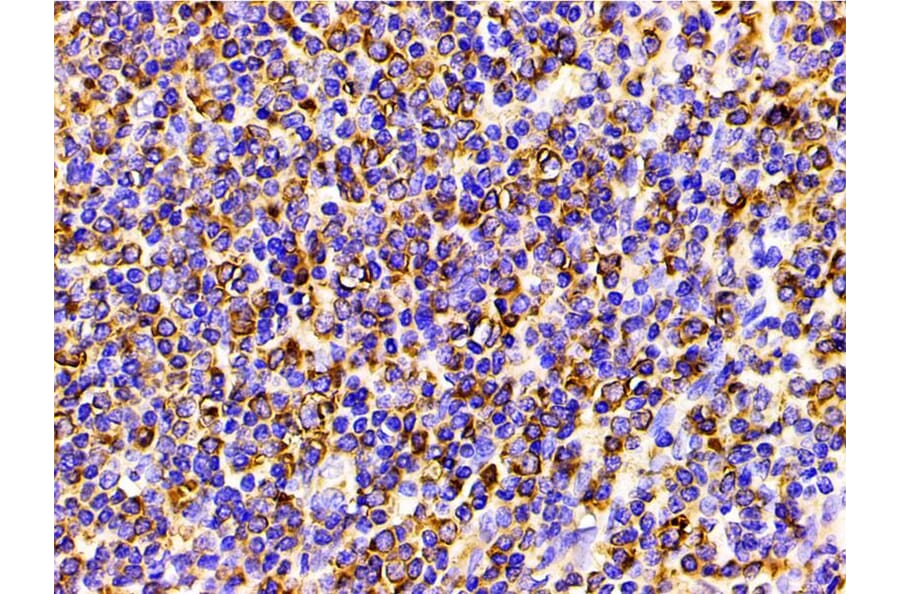 Validation Data - Anti-PI3K p85 alpha (phospho Tyr607) Antibody (A255498)