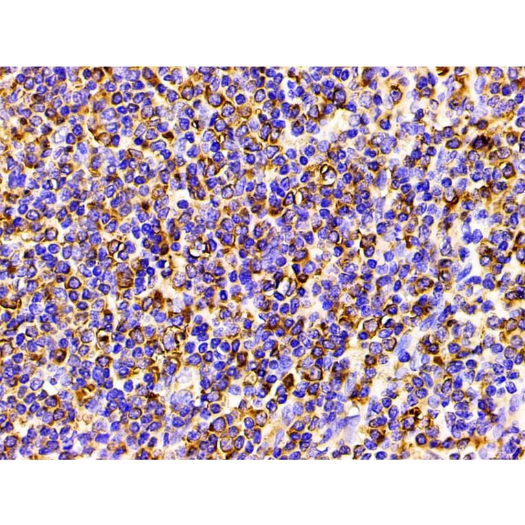 Validation Data - Anti-PI3K p85 alpha (phospho Tyr607) Antibody (A255498)