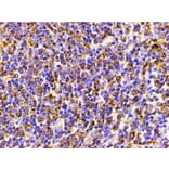 Validation Data - Anti-PI3K p85 alpha (phospho Tyr607) Antibody (A255498)