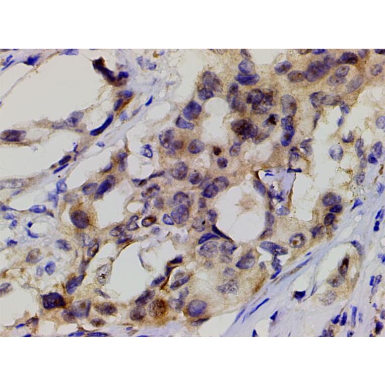Validation Data - Anti-PI3K p85 alpha (phospho Tyr607) Antibody (A255498)