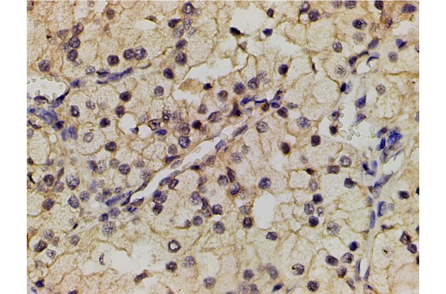 Validation Data - Anti-PI3K p85 alpha (phospho Tyr607) Antibody (A255498)