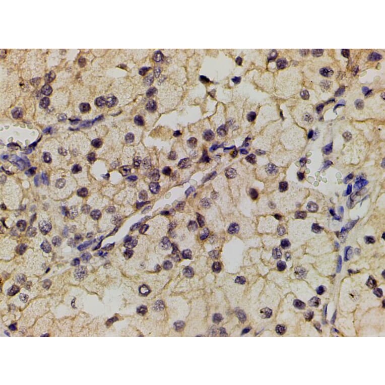 Validation Data - Anti-PI3K p85 alpha (phospho Tyr607) Antibody (A255498)