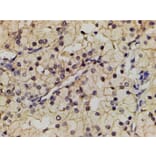 Validation Data - Anti-PI3K p85 alpha (phospho Tyr607) Antibody (A255498)
