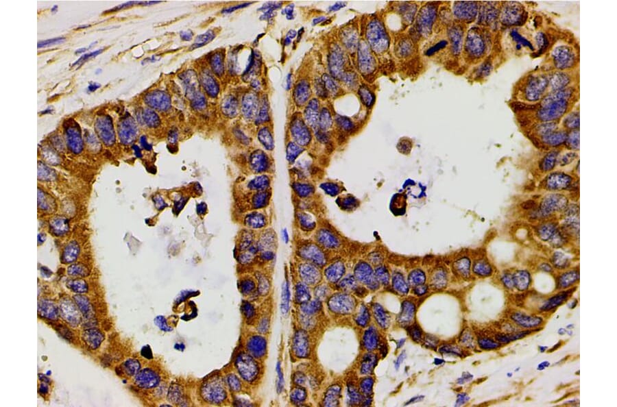 Validation Data - Anti-PI3K p85 alpha (phospho Tyr607) Antibody (A255498)