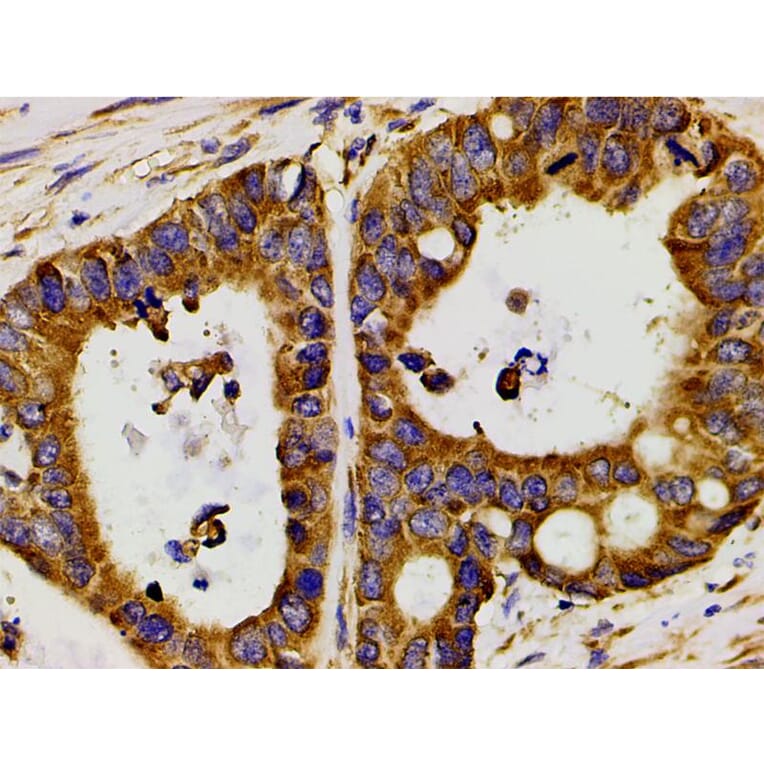 Validation Data - Anti-PI3K p85 alpha (phospho Tyr607) Antibody (A255498)