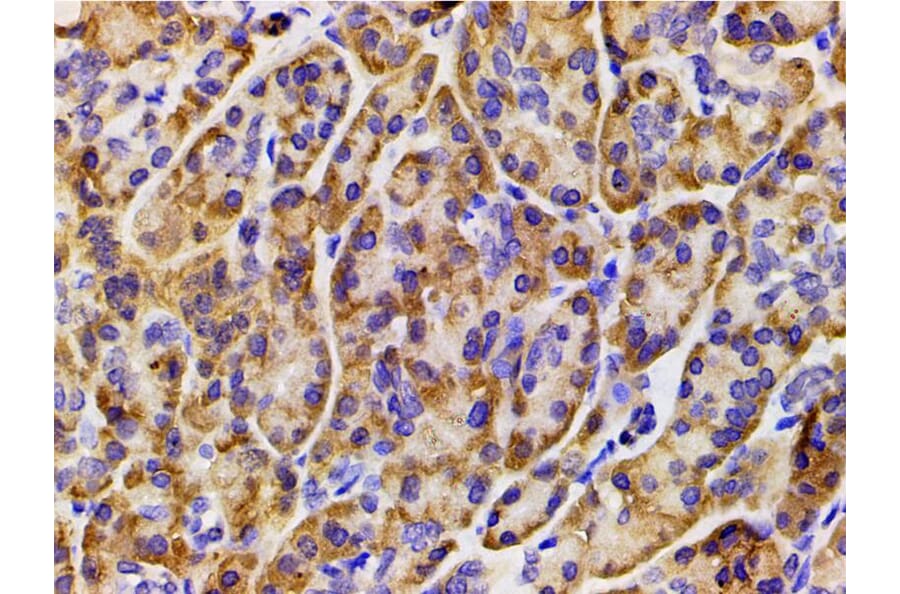 Validation Data - Anti-PI3K p85 alpha (phospho Tyr607) Antibody (A255498)