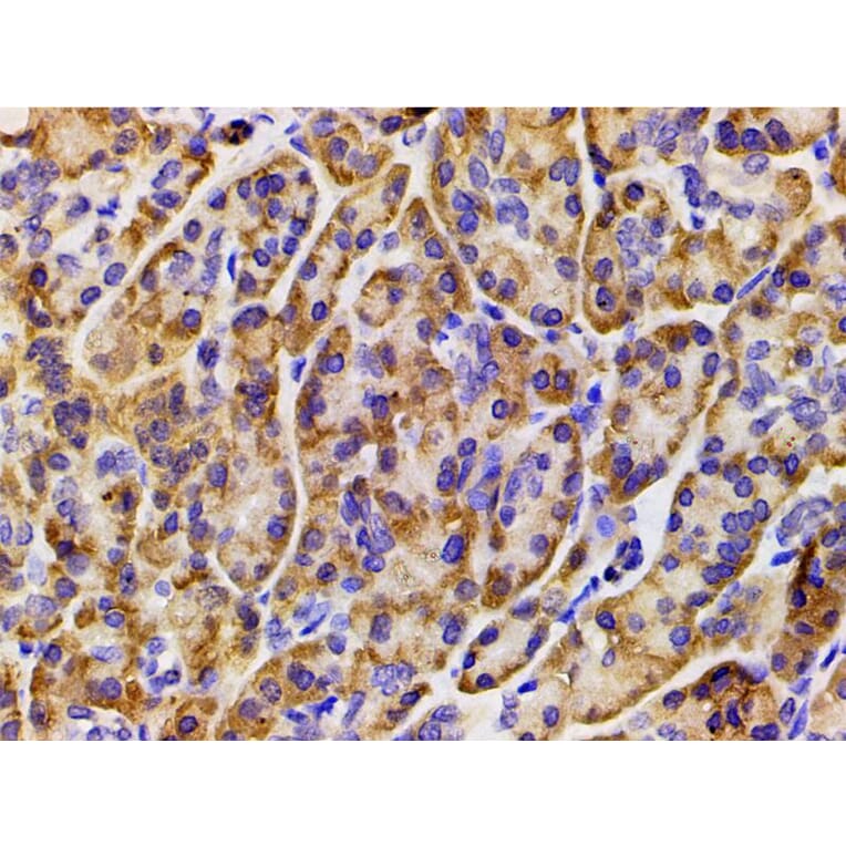 Validation Data - Anti-PI3K p85 alpha (phospho Tyr607) Antibody (A255498)