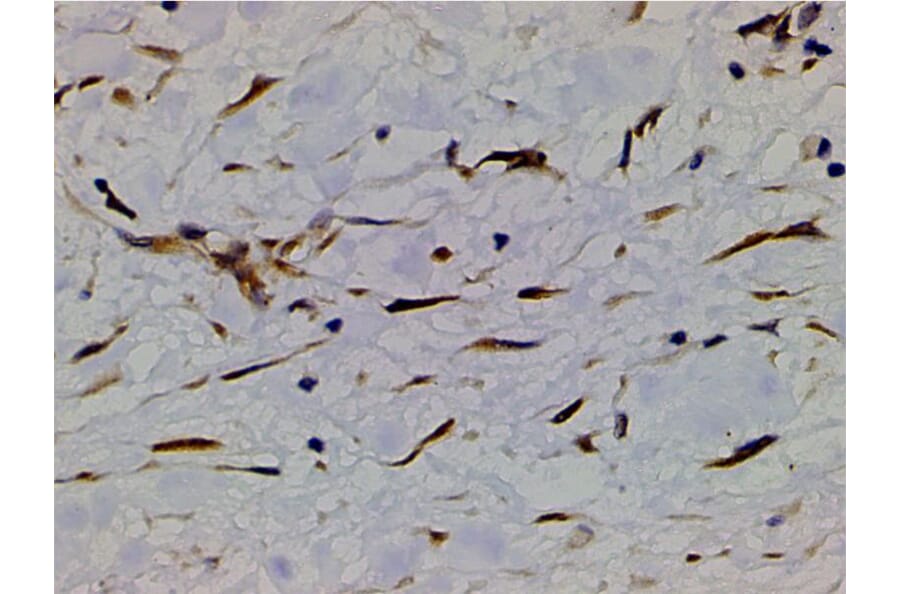Validation Data - Anti-PI3K p85 alpha (phospho Tyr607) Antibody (A255498)