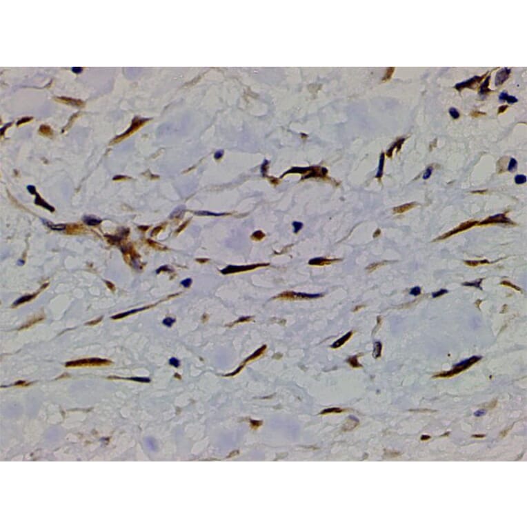 Validation Data - Anti-PI3K p85 alpha (phospho Tyr607) Antibody (A255498)