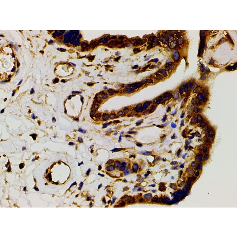 Validation Data - Anti-PI3K p85 alpha (phospho Tyr607) Antibody (A255498)