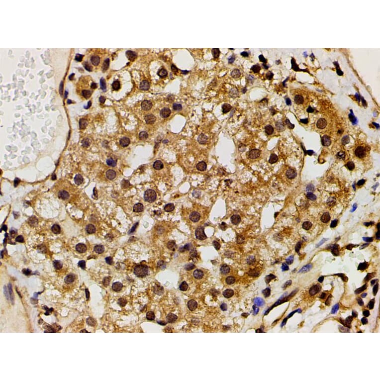 Validation Data - Anti-PI3K p85 alpha (phospho Tyr607) Antibody (A255498)