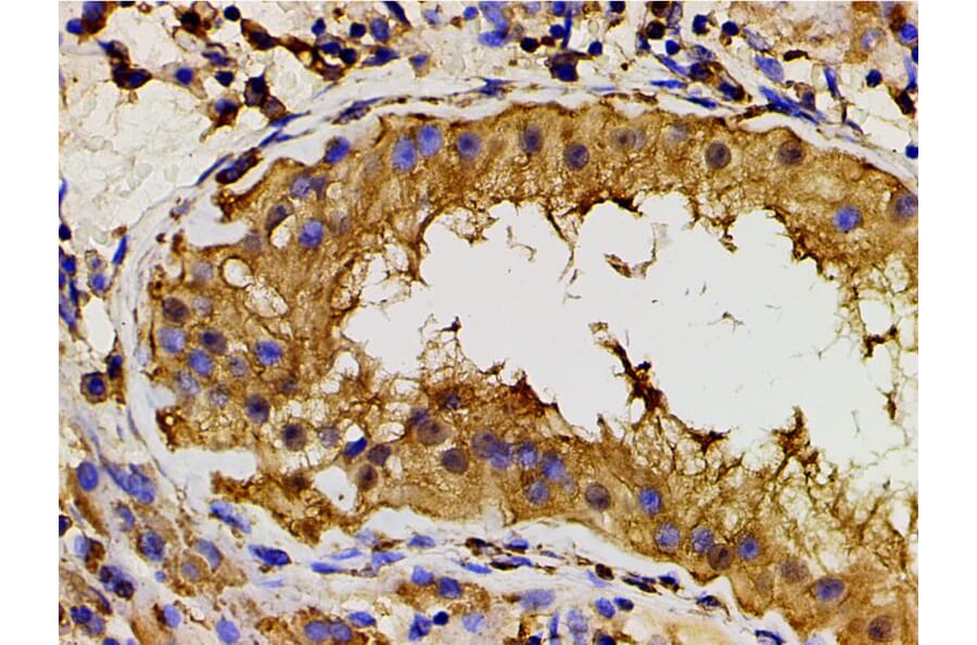 Validation Data - Anti-PI3K p85 alpha (phospho Tyr607) Antibody (A255498)
