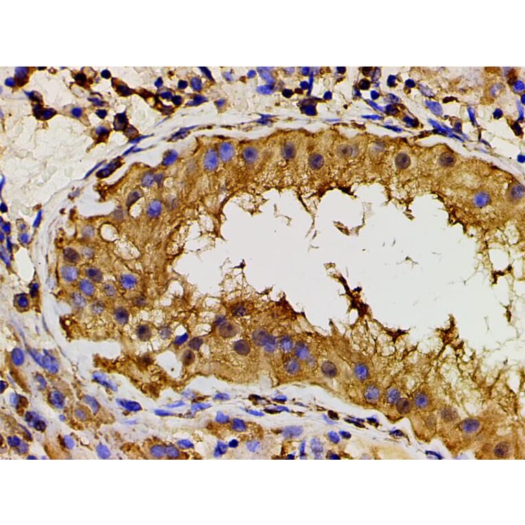 Validation Data - Anti-PI3K p85 alpha (phospho Tyr607) Antibody (A255498)