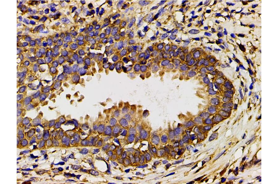 Validation Data - Anti-PI3K p85 alpha (phospho Tyr607) Antibody (A255498)