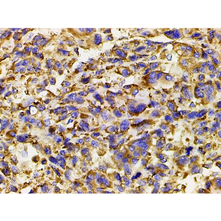 Validation Data - Anti-PI3K p85 alpha (phospho Tyr607) Antibody (A255498)