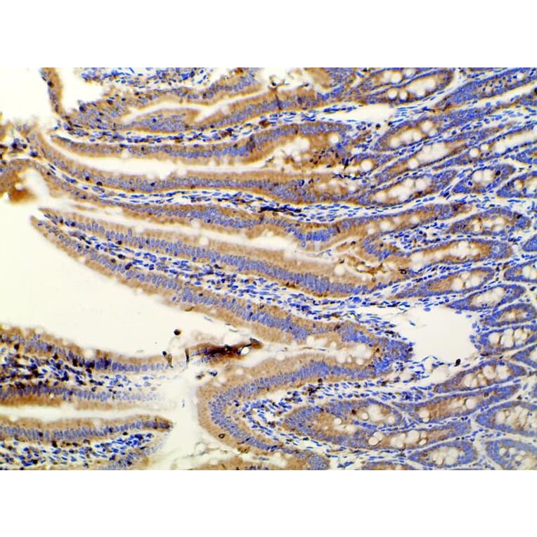 Validation Data - Anti-PI3K p85 alpha (phospho Tyr607) Antibody (A255498)