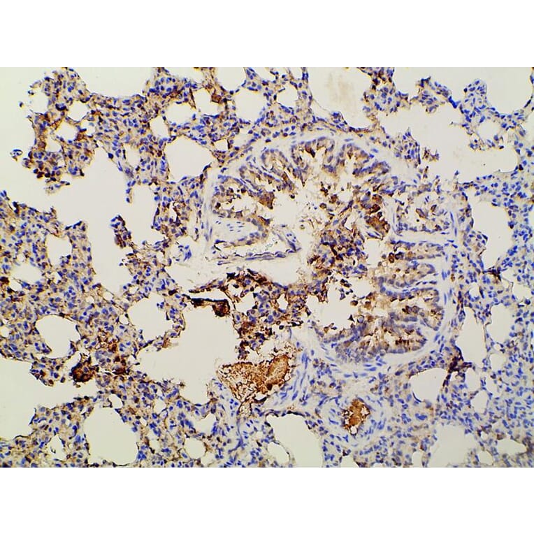 Validation Data - Anti-PI3K p85 alpha (phospho Tyr607) Antibody (A255498)