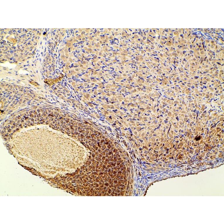 Validation Data - Anti-PI3K p85 alpha (phospho Tyr607) Antibody (A255498)