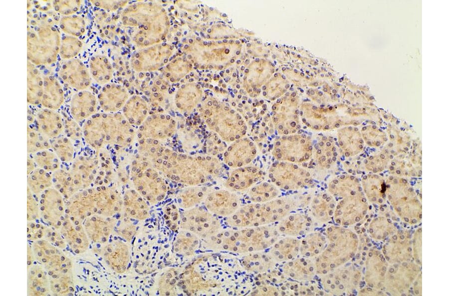 Validation Data - Anti-PI3K p85 alpha (phospho Tyr607) Antibody (A255498)