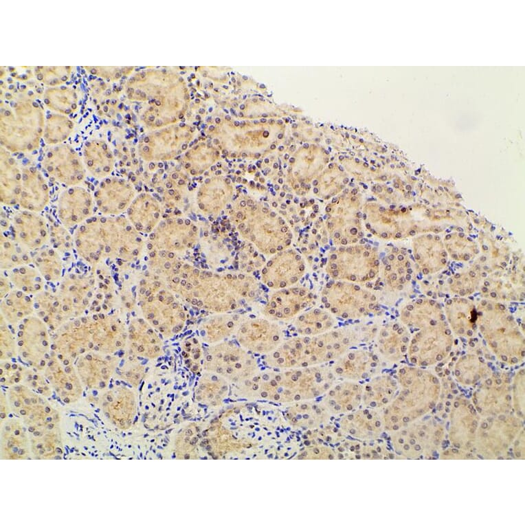 Validation Data - Anti-PI3K p85 alpha (phospho Tyr607) Antibody (A255498)
