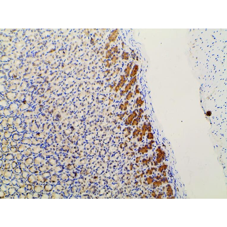 Validation Data - Anti-PI3K p85 alpha (phospho Tyr607) Antibody (A255498)