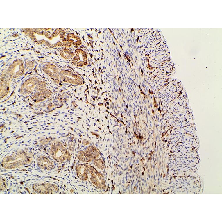 Validation Data - Anti-PI3K p85 alpha (phospho Tyr607) Antibody (A255498)