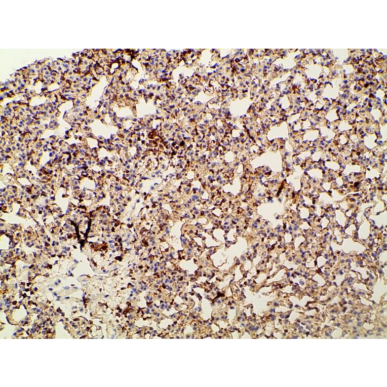 Validation Data - Anti-PI3K p85 alpha (phospho Tyr607) Antibody (A255498)